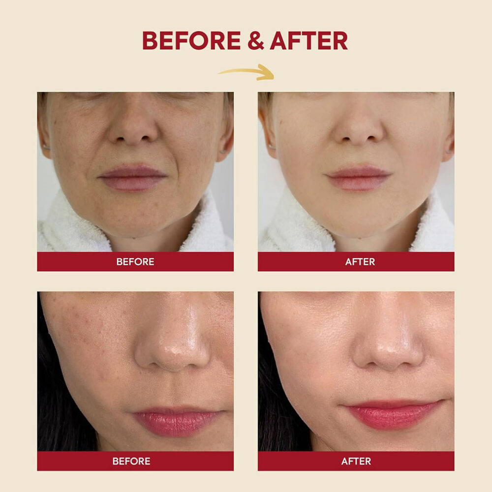 اسنس موسین حلزون و برنج سئول 1988 کی سکرت K-SECRET SEOUL 1988 Essence Snail Mucin 97% + Rice