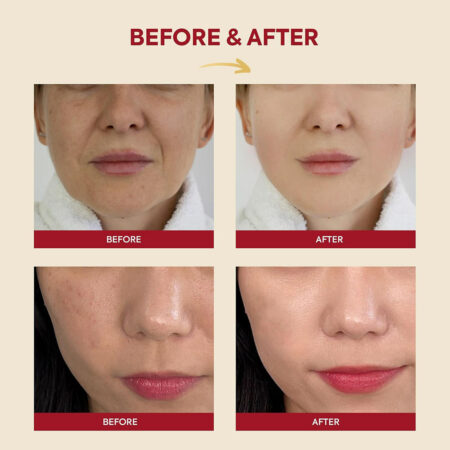اسنس موسین حلزون و برنج سئول 1988 کی سکرت K-SECRET SEOUL 1988 Essence Snail Mucin 97% + Rice