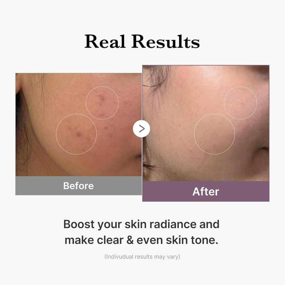 تونر گلوتاتیون مدی کیوب Medicube Age-R Glutathione Glow Toner