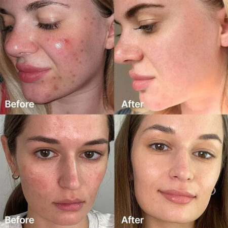 سرم ضد جوش سوکسینیک اسید مدی کیوب Medicube Red Succinic Acid Serum