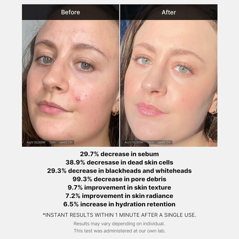 سرم لایه بردار سوکسینیک اسید مدی کیوب Medicube Red Acne Succinic Acid Peel