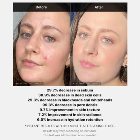 سرم لایه بردار سوکسینیک اسید مدی کیوب Medicube Red Acne Succinic Acid Peel
