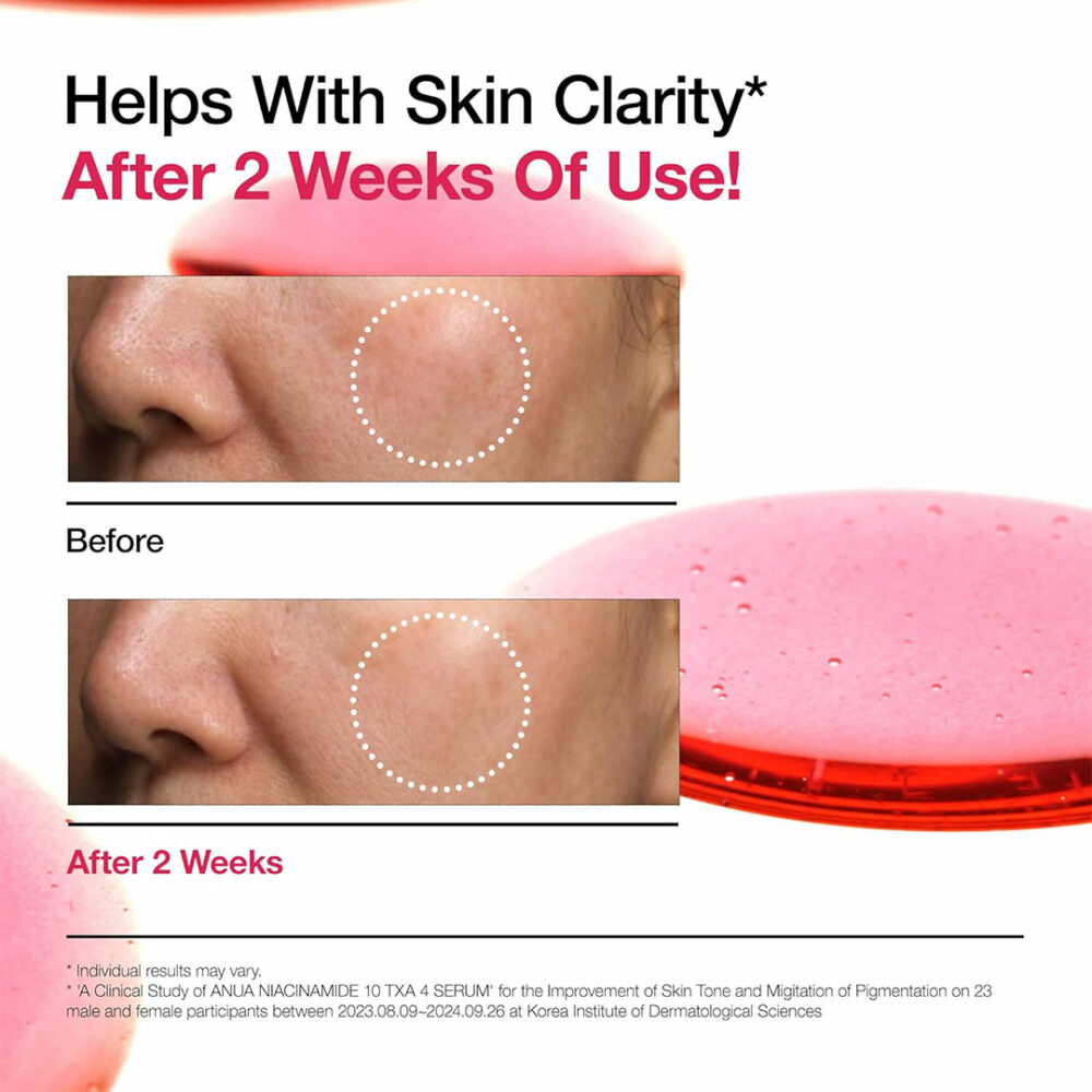 سرم نیاسینامید 10% + ترانگزامیک اسید 4% آنوا Anua Niacinamide 10% + TXA 4% Dark Spot Correcting Serum