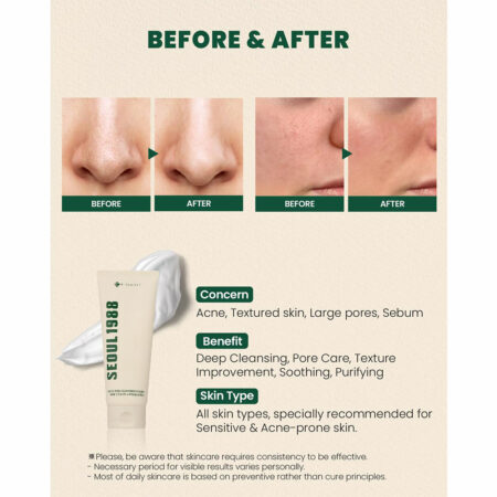 فوم شستشوی کاج سیکا ۱٪ + پروبیوتیک کی سکرت K-SECRET SEOUL 1988 Cleansing Foam Pine Cica 1% + Probiotics