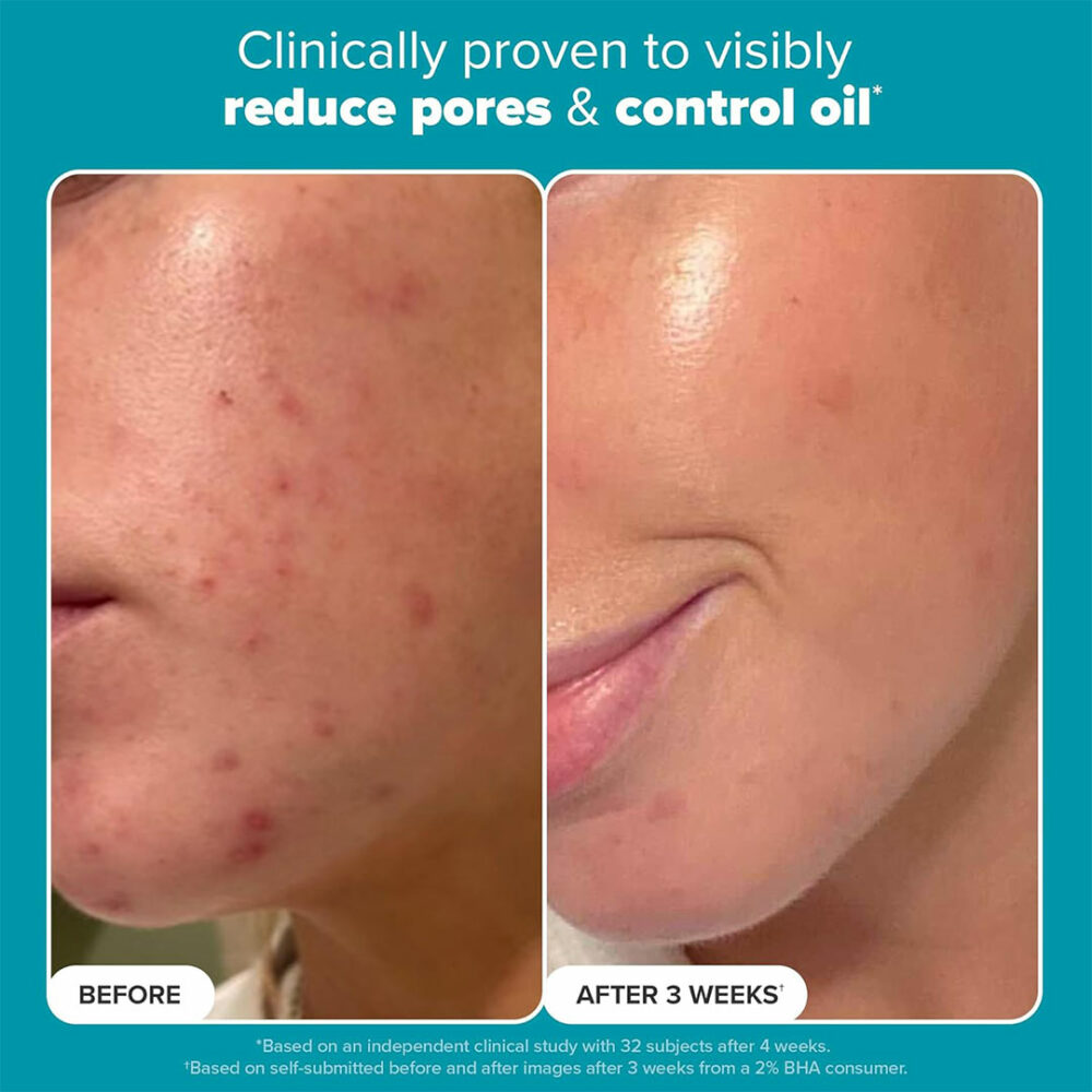 محلول لایه بردار مایع BHA پائولا چویس Paula's Choice Skin Perfecting 2% BHA Liquid Exfoliant