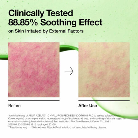پد تونر آزلائیک اسید 10% و هیالورون آنوا Anua Azelaic 10 Hyaluron Redness Soothing Pad