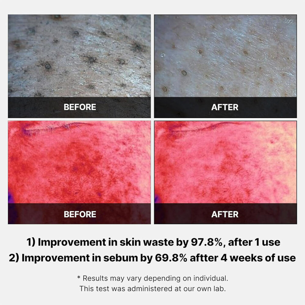پد تونر سوکسینیک اسید مدی کیوب Medicube Red Succinic Acid Peeling Pad