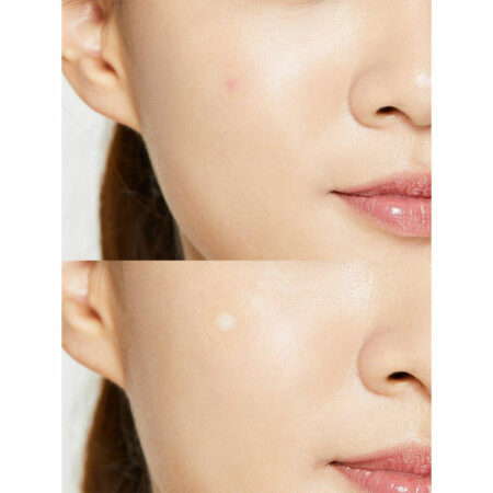 پچ ضد جوش کوزارکس Cosrx Acne Pimple Master Patch